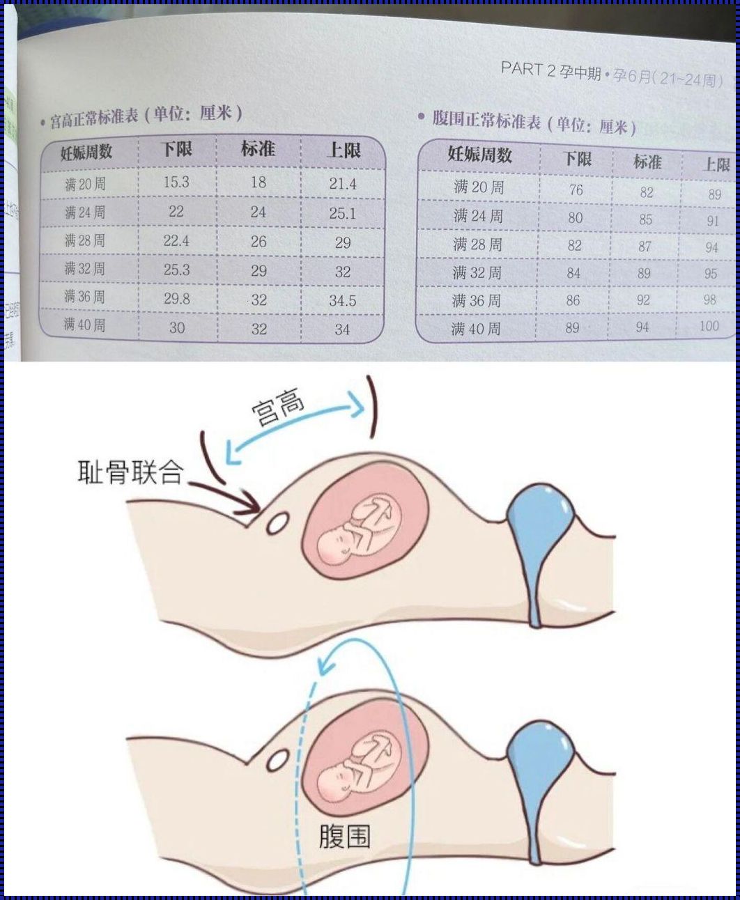 37周孕妇腹围355毫米是否正常？深度解析与探讨