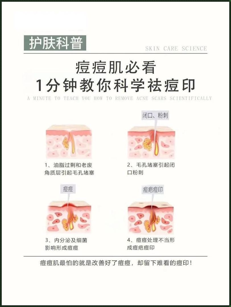 怎么科学祛痘印：寻找美丽的再造之路