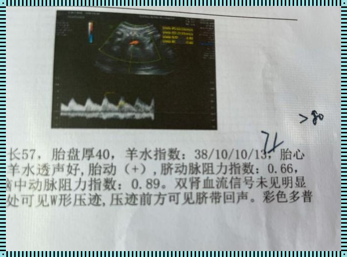 35周羊水77mm需要住院吗：关于孕期羊水量的深度解析