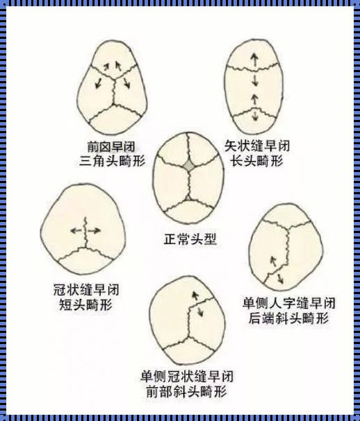 宝宝多大可以排除舟状头