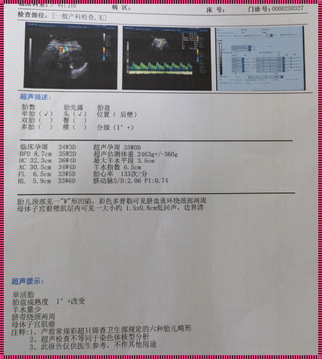 孕晚期羊水33mm正常吗？揭秘羊水量的真相