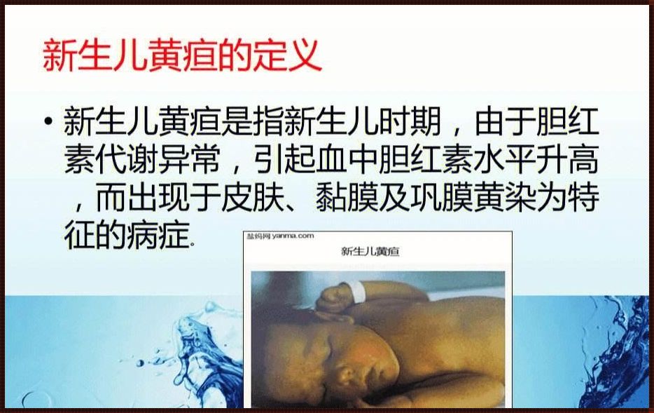 黄疸新生儿是什么引起的——揭秘新生儿黄疸的神秘面纱