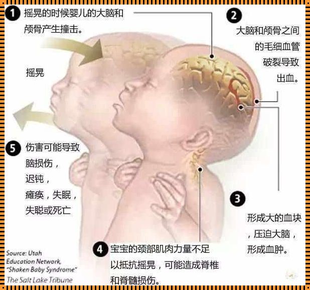 怎么判断宝宝脑损伤