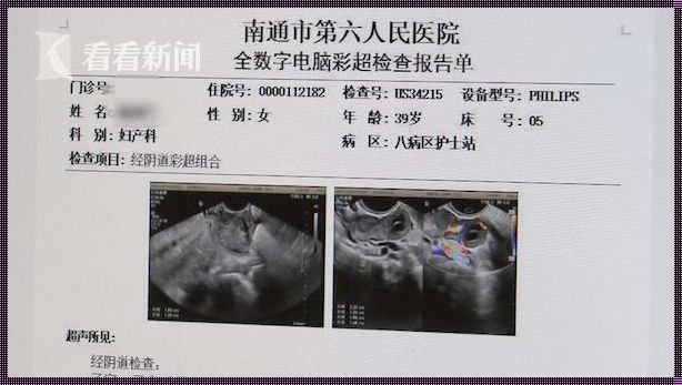 怀孕一个月：生命的奇迹，科技的见证