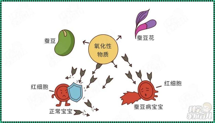 蚕豆病：一个被忽视的遗传性疾病的深度解析