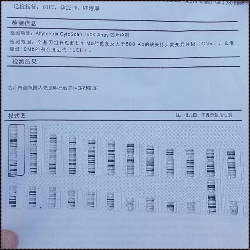 《羊水穿刺预期XY，惊喜揭晓是位小女孩》