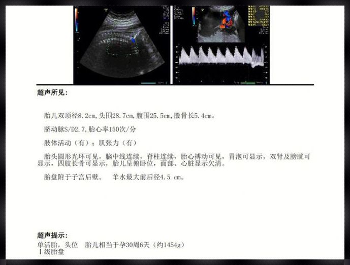 孕29周股骨长55mm小孩腿短吗：探索生命的奇迹与成长的秘密