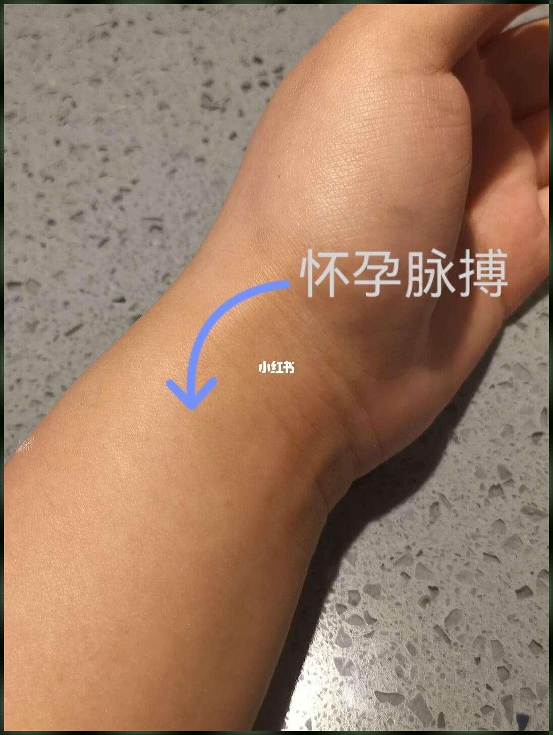 滑脉的奥秘：月经与怀孕的微妙区别