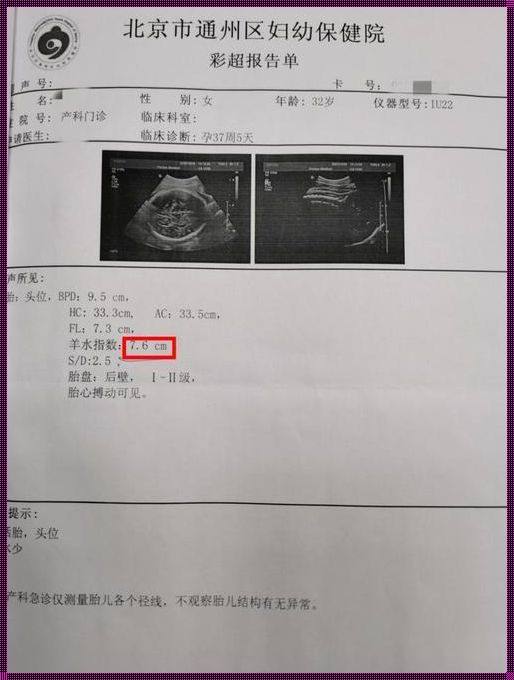 38周羊水最大深度50mm：生命之水的奥秘与期待