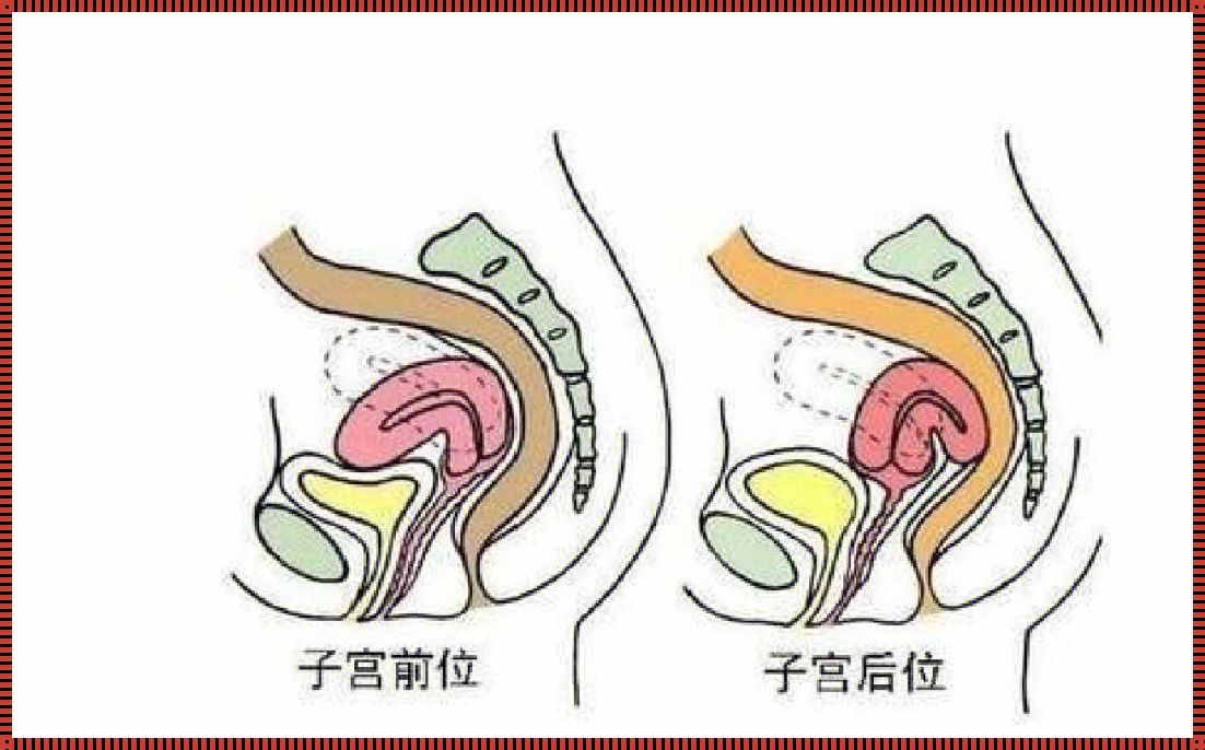 子宫后位如何提高怀孕几率：探寻生命之源的奥秘