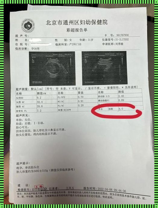 孕期水分摄入与羊水健康：科学指南