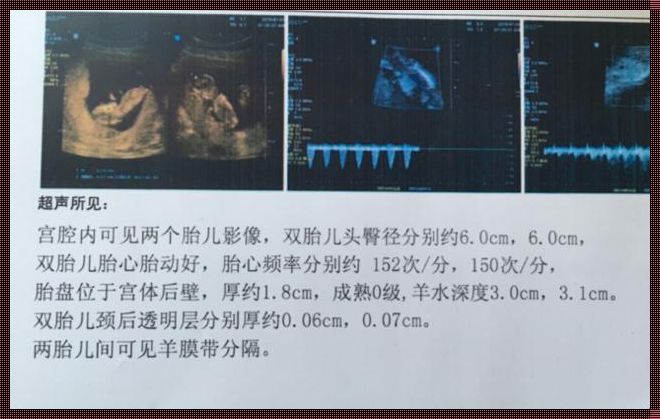 怀孕一个月能否识别双胞胎的奥秘