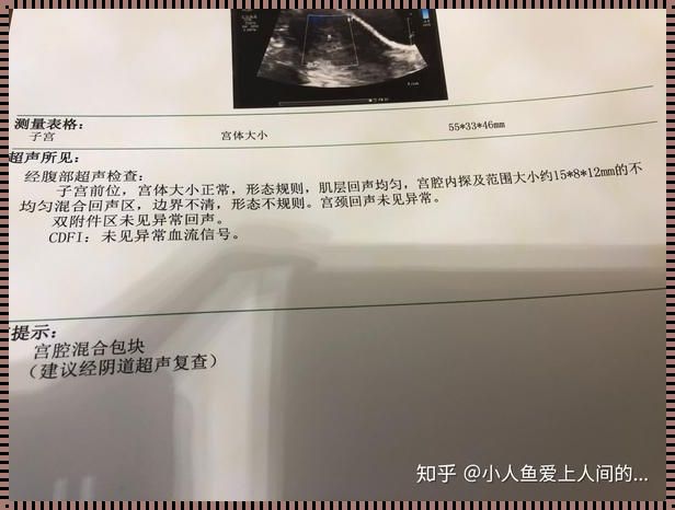 怀孕40天药流成功率高吗：生命选择与女性健康