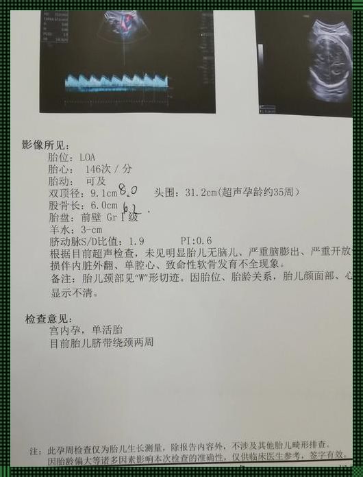 双顶径9.0宝宝头大吗：育儿经验中的科学与爱