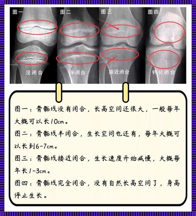 生命之骨：骨骺线闭合的自然律动