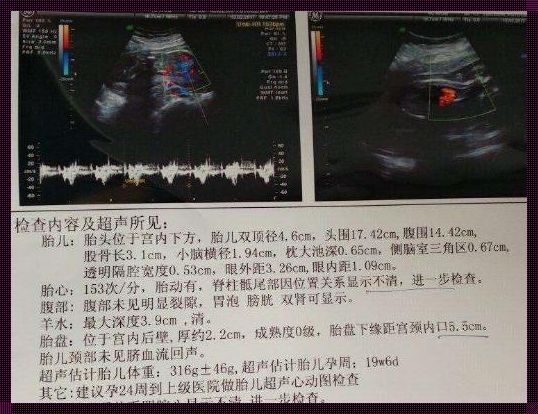 胎儿的身高，未来的希望——揭秘b超胎儿身高计算