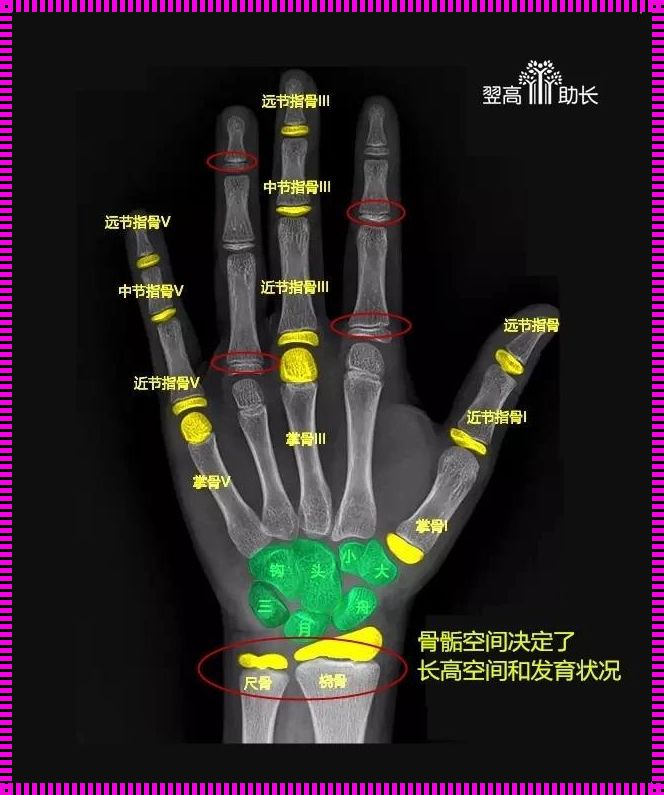 探索成长的秘密：儿童骨龄检测的意义