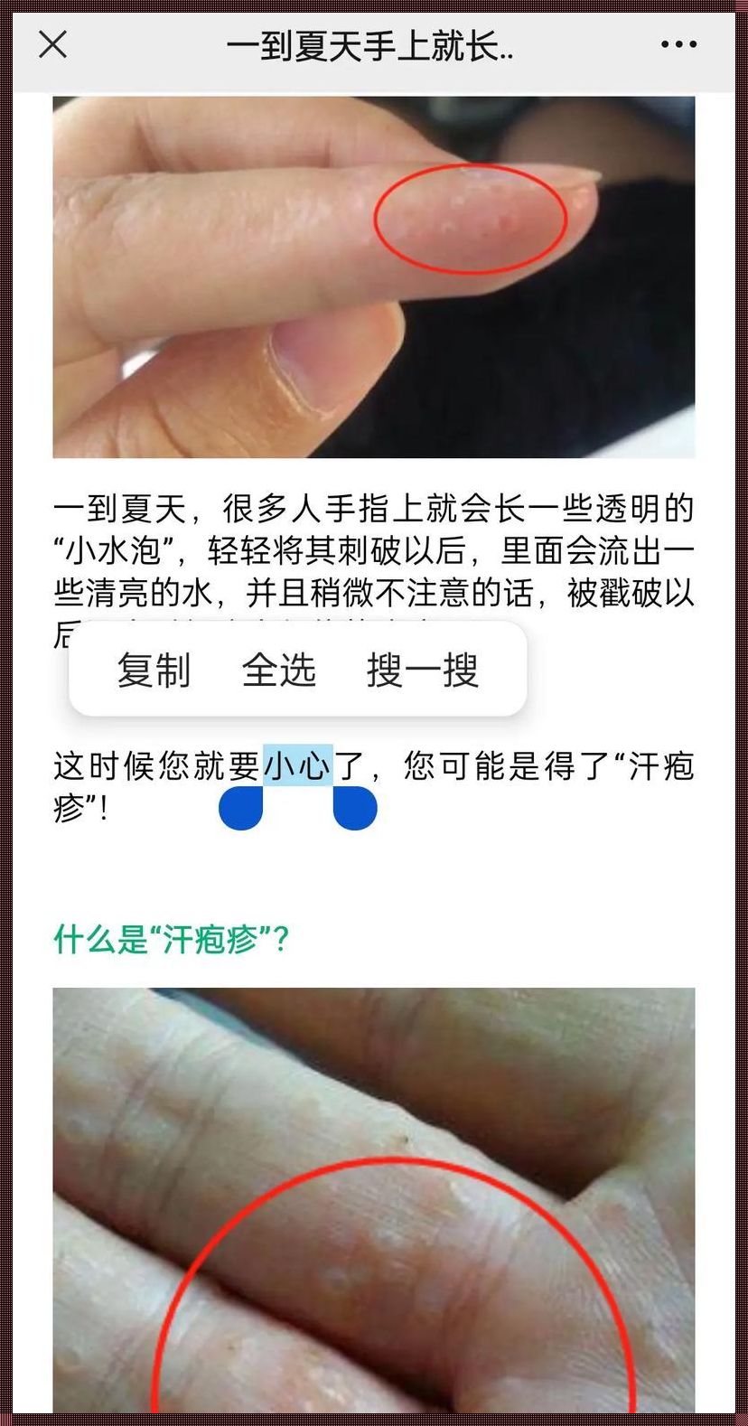 揭秘：疱疹几年后复发减少，孕期知识大盘点！