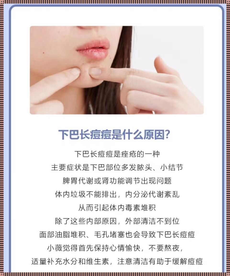 下巴长粉刺的中医解读：美丽问题，中医有招