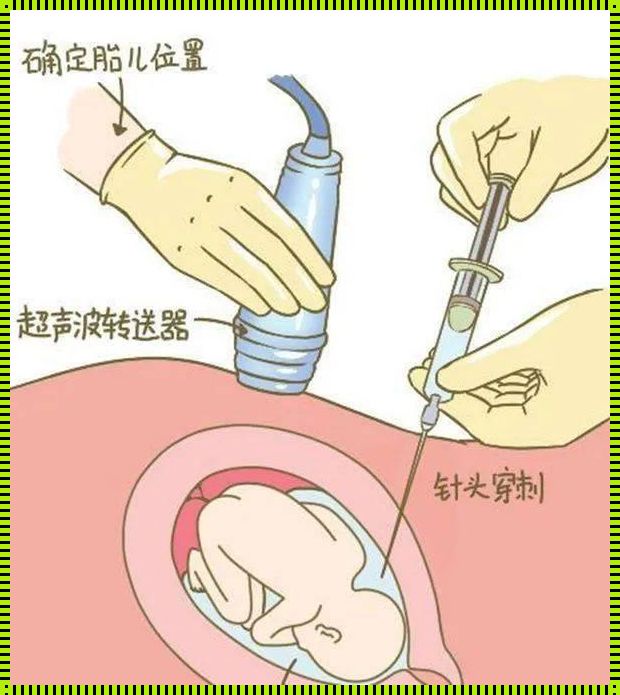 探秘怀孕知识：唐筛做B超，真能透视宝宝的性别吗？