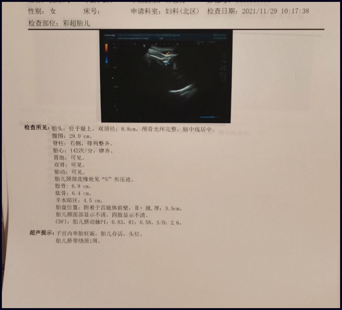 胎儿后两个月能否华丽逆袭，勇夺四斤增长？