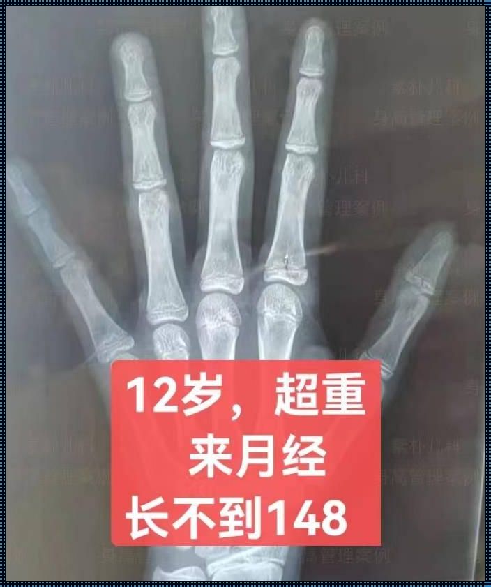 备孕年龄之谜：14岁骨龄真的正常吗？