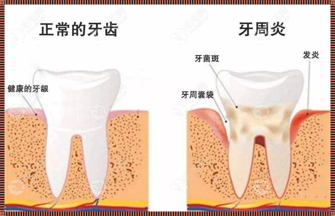 当牙齿的位置被“入侵”时：一场育儿的奇妙之旅