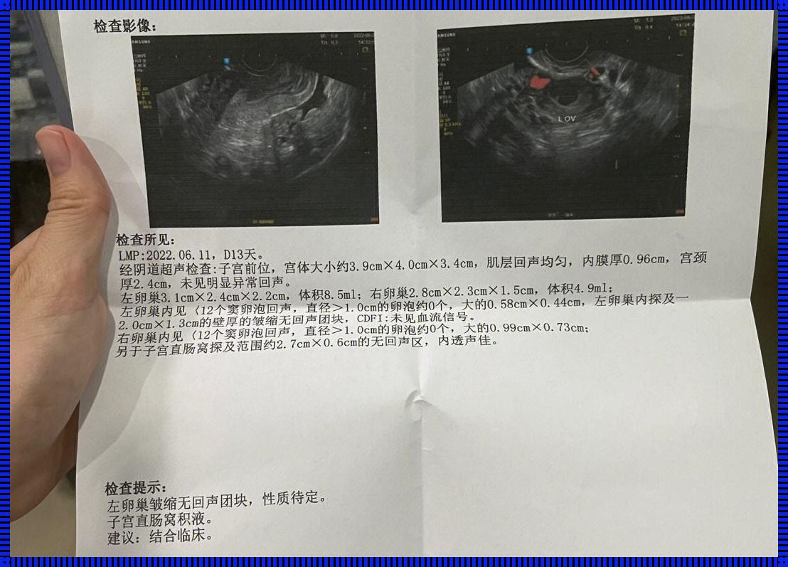 有少量出血能做阴超检查吗？深入解析与探讨