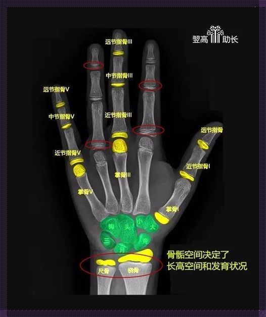 骨龄预测：解锁儿童成长潜力的秘密