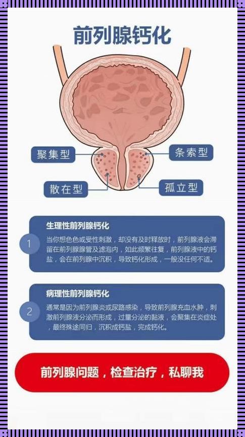 前列腺轻度增生伴结石严重吗？深度解析与探究