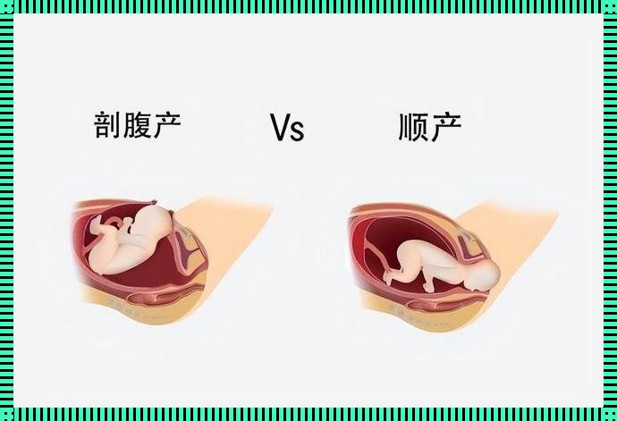 破腹产7年后再怀有没有危险