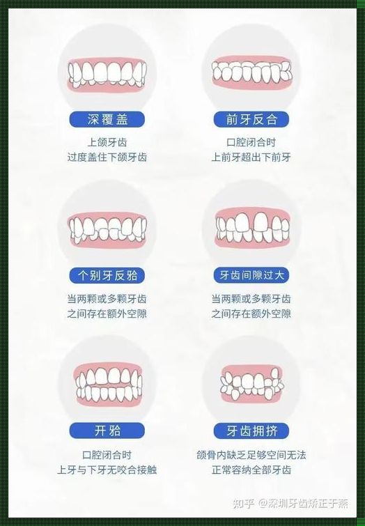 儿童治疗一颗牙齿多少钱