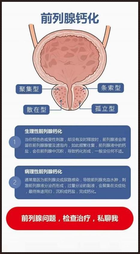 “石敢当”前列腺，危险游戏谁敢玩？