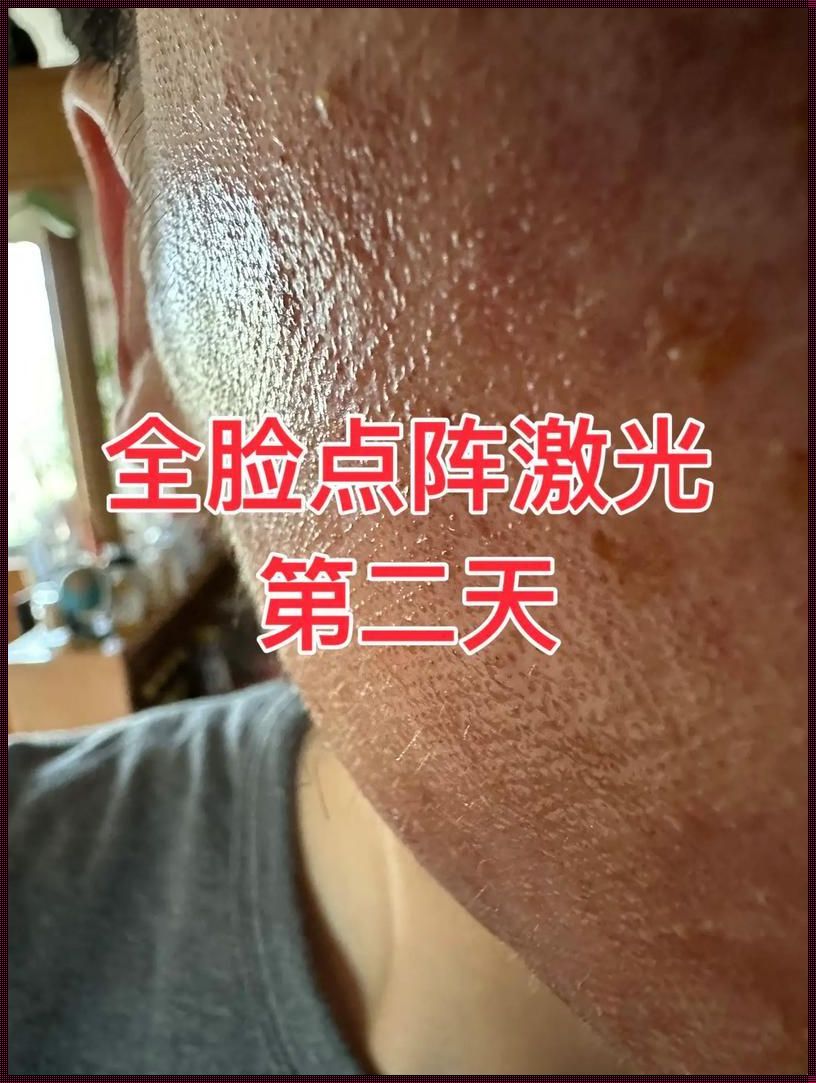 “点阵激光骗局”：揭秘爱的童话与江湖术士的较量