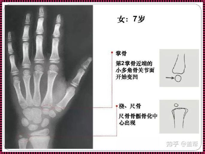 7岁136cm，骨龄多少才算正常？探秘成长的奇妙旅程