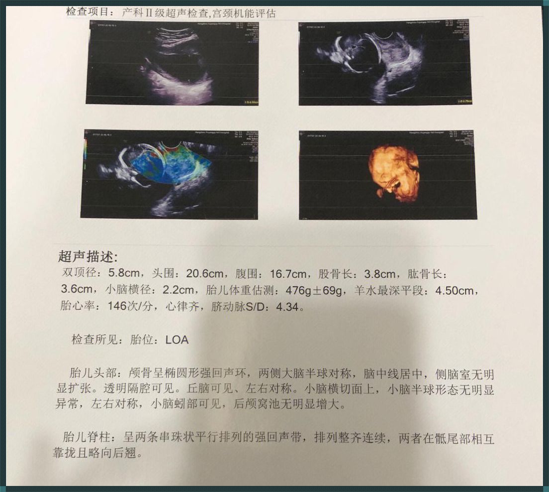 《四维骶尾部略向后翘：宇宙的顽皮一笑》