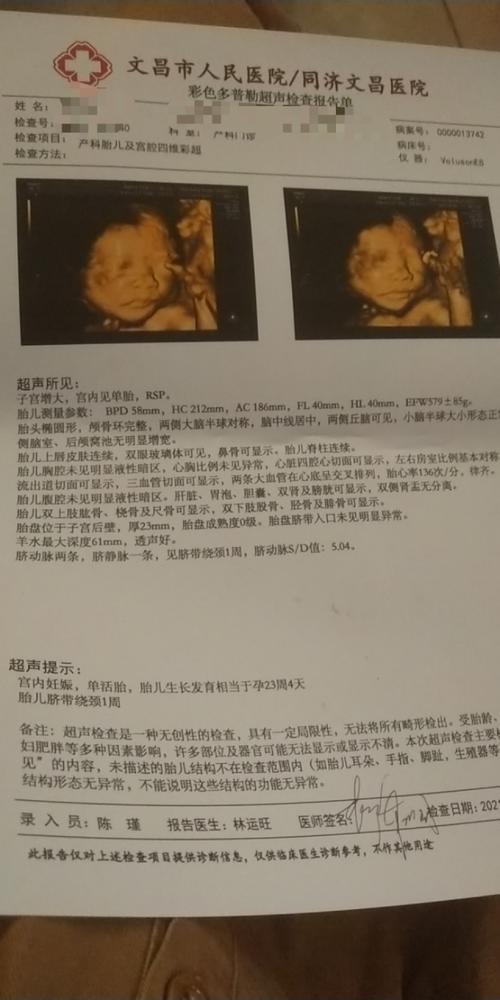 “四维单子”探秘：性别标签的荒诞秀