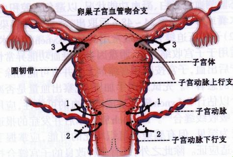 “子宫动脉上行结扎图解”：幽默解剖指南