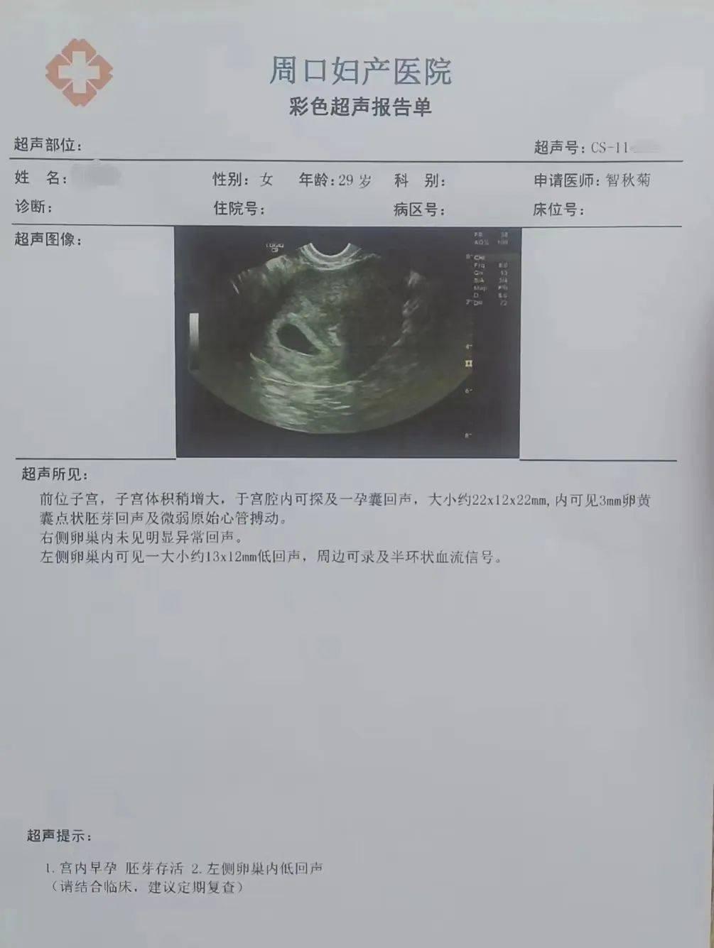 宫腔黏连，B超单上的隐形嘲讽