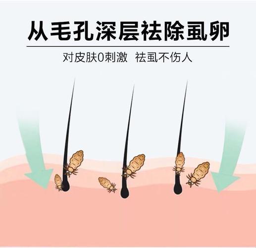 蒸走阴虱，半晌足矣？探秘汗蒸奇效之谜