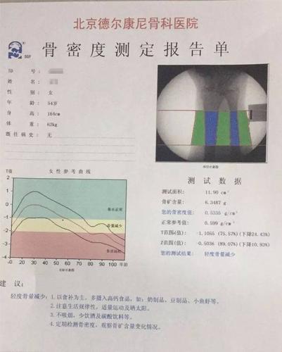 骨密度检查，揭秘你不知道的“骨头秘密”