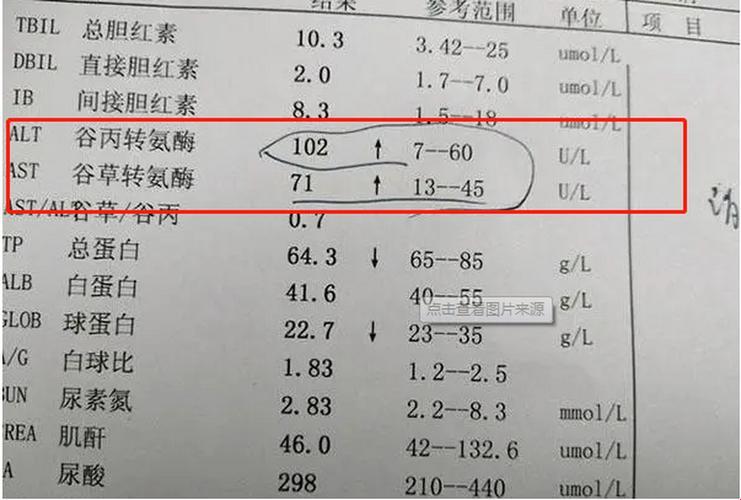 “肝”心无奈，谷丙转氨酶偏高是闹哪样？