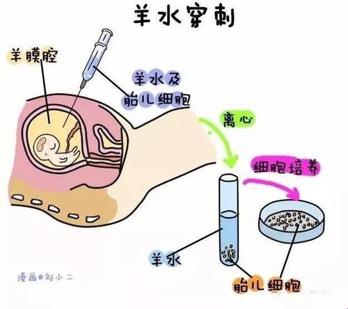 羊水培养，揭秘胎儿成长的“水晶球”之谜