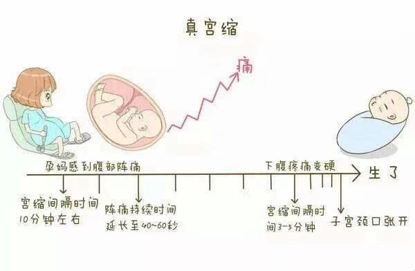 宫缩之谜：原是子宫在偷懒