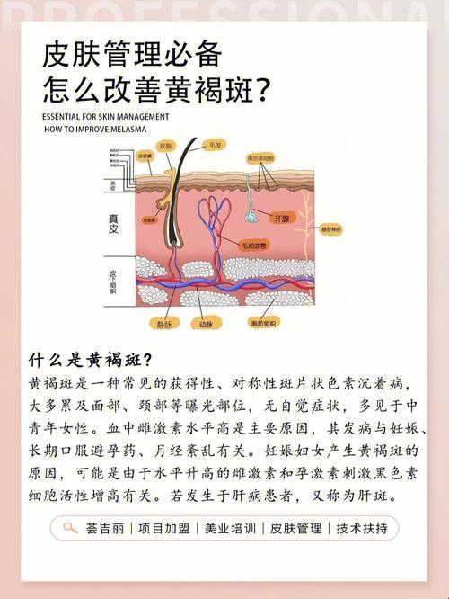 斑点江湖，图解淡世之术