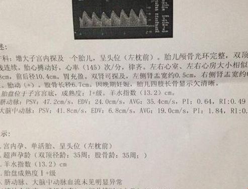 B超单上的腿长谜团：标准数据背后的笑料