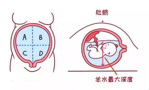 “羊水溢出，早晚有别？探讨孕妇水中生活的奥秘”