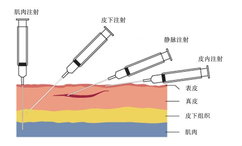 打疫苗，趣谈千姿百态的“入针艺术”