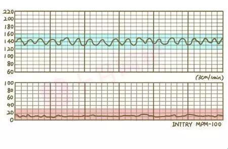 “37周胎心115-120，孕妈咪的心跳大赛？