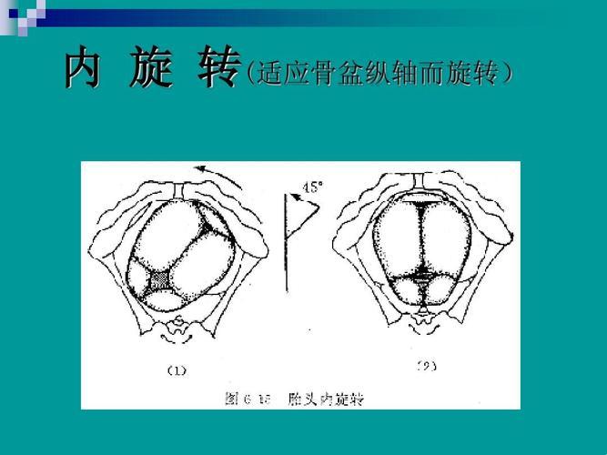 顺转剖什么鬼？笑谈分娩的意外之旅